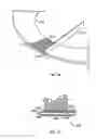 Fig. 09 - Method and apparatus for body fluid sampling and analyte sensing