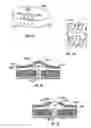 Fig. 12 - Method and apparatus for body fluid sampling and analyte sensing