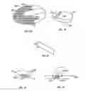 Fig. 14 - Method and apparatus for body fluid sampling and analyte sensing