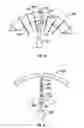 Fig. 31 - Method and apparatus for body fluid sampling and analyte sensing