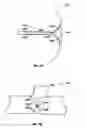 Fig. 77 - Method and apparatus for body fluid sampling and analyte sensing