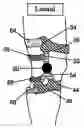 Fig. 01 - Non-surgical correcting abnormal knee loading