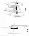 Fig. 04 - Non-surgical correcting abnormal knee loading