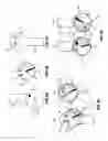 Fig. 05 - Non-surgical correcting abnormal knee loading
