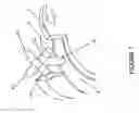 Fig. 08 - Non-surgical correcting abnormal knee loading