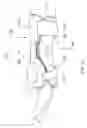 Fig. 04 - Fracture brace