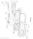 Fig. 05 - Fracture brace