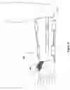 Fig. 12 - Fracture brace