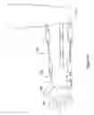 Fig. 13 - Fracture brace