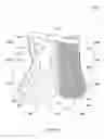 Fig. 17 - Fracture brace