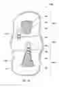 Fig. 27 - Fracture brace