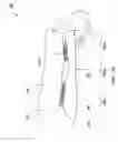 Fig. 31 - Fracture brace