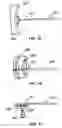 Fig. 10 - Range of motion device