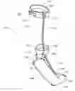 Fig. 01 - Device for treating foot drop