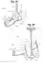 Fig. 04 - Device for treating foot drop