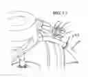 Fig. 52 - Method for collecting a desired blood component and performing a photopheresis treatment