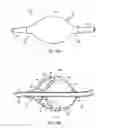 Fig. 03 - Apparatus and methods for clearing obstructions from surgical cutting instruments