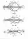 Fig. 04 - Apparatus and methods for clearing obstructions from surgical cutting instruments