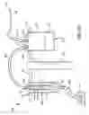 Fig. 12 - Tissue transplantation method and apparatus