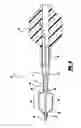 Fig. 05 - Catheter with balloon material having visual marker