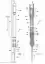 Fig. 03 - Safety catheter system and method