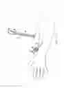 Fig. 11 - Safety catheter system and method