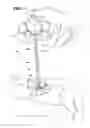Fig. 02 - Needle assembly for radiating bioactive compounds through tissue
