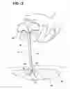 Fig. 03 - Needle assembly for radiating bioactive compounds through tissue