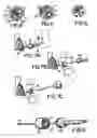 Fig. 03 - Device for targeted, catherized delivery of medications