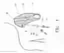 Fig. 02 - Catheter fluid lock method and device