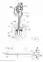 Fig. 02 - APPARATUS AND METHODS FOR TREATING CONGESTIVE HEART DISEASE