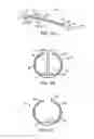 Fig. 03 - Methods and kits for delivering pharmaceutical agents into the coronary vascular adventitia