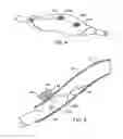 Fig. 06 - Methods and kits for delivering pharmaceutical agents into the coronary vascular adventitia