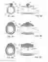 Fig. 07 - Methods and kits for delivering pharmaceutical agents into the coronary vascular adventitia
