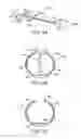 Fig. 03 - Methods and kits for delivering pharmaceutical agents into the coronary vascular adventitia