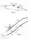 Fig. 06 - Methods and kits for delivering pharmaceutical agents into the coronary vascular adventitia