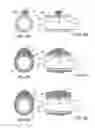 Fig. 07 - Methods and kits for delivering pharmaceutical agents into the coronary vascular adventitia
