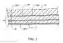 Fig. 02 - Methods and kits-for delivering pharmaceutical agents into the coronary vascular adventitia