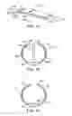 Fig. 03 - Methods and kits-for delivering pharmaceutical agents into the coronary vascular adventitia