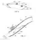 Fig. 06 - Methods and kits-for delivering pharmaceutical agents into the coronary vascular adventitia