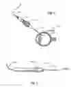 Fig. 06 - Surgical variable-angle illuminator