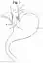 Fig. 02 - Methods and systems for determining physiologic characteristics for treatment of the esophagus