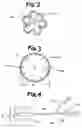 Fig. 03 - Methods and systems for determining physiologic characteristics for treatment of the esophagus