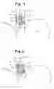 Fig. 06 - Methods and systems for determining physiologic characteristics for treatment of the esophagus