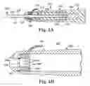 Fig. 06 - Instrument and system for surgical cutting and evoked potential monitoring