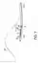 Fig. 08 - High frequency incision instrument for endoscope