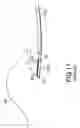 Fig. 12 - High frequency incision instrument for endoscope