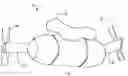 Fig. 01 - Orthopaedic instrument joint, instrument and associated method