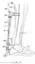 Fig. 08 - Orthopaedic instrument joint, instrument and associated method