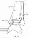 Fig. 29 - Orthopaedic instrument joint, instrument and associated method